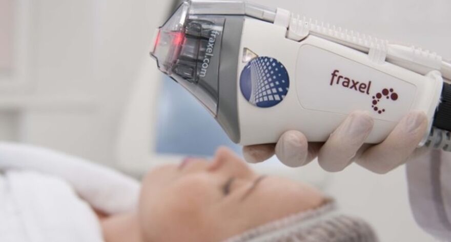 fractional machine for skin resurfacing