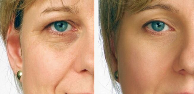 before and after