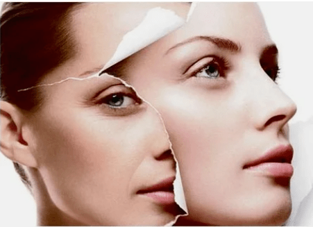 Facial laser rejuvenation procedure for the contraindications