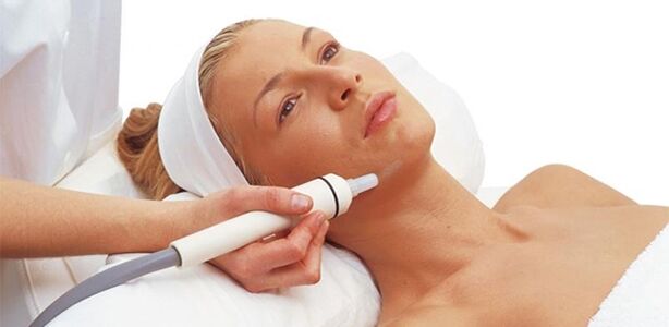 Face peeling