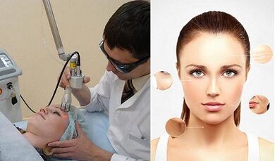 How laser skin rejuvenation is performed