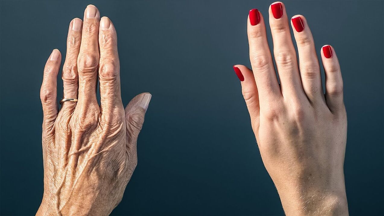Effective ways to rejuvenate the skin of your hands