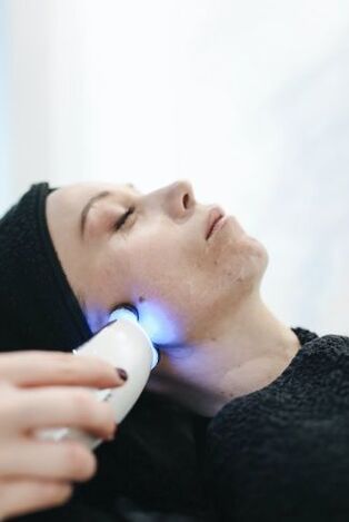 Facial skin rejuvenation with laser