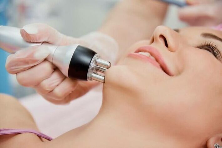 Radio wave lifting is an effective procedure for facial skin rejuvenation