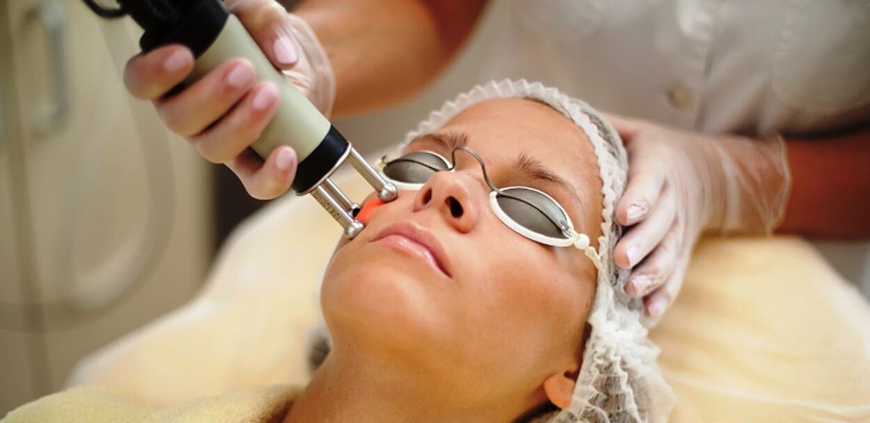 Laser facial rejuvenation - non-surgical procedure for wrinkles